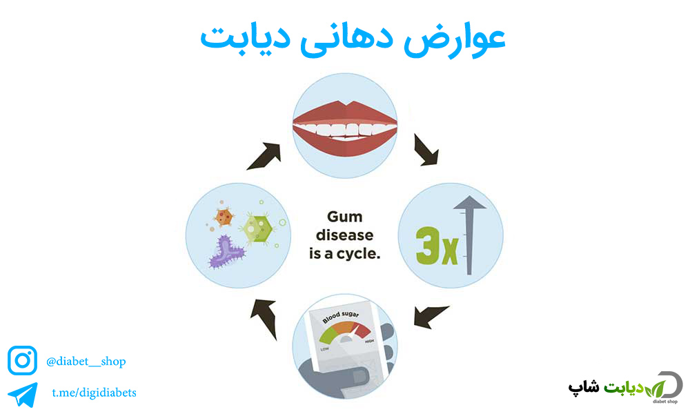 عوارض دهانی دیابت