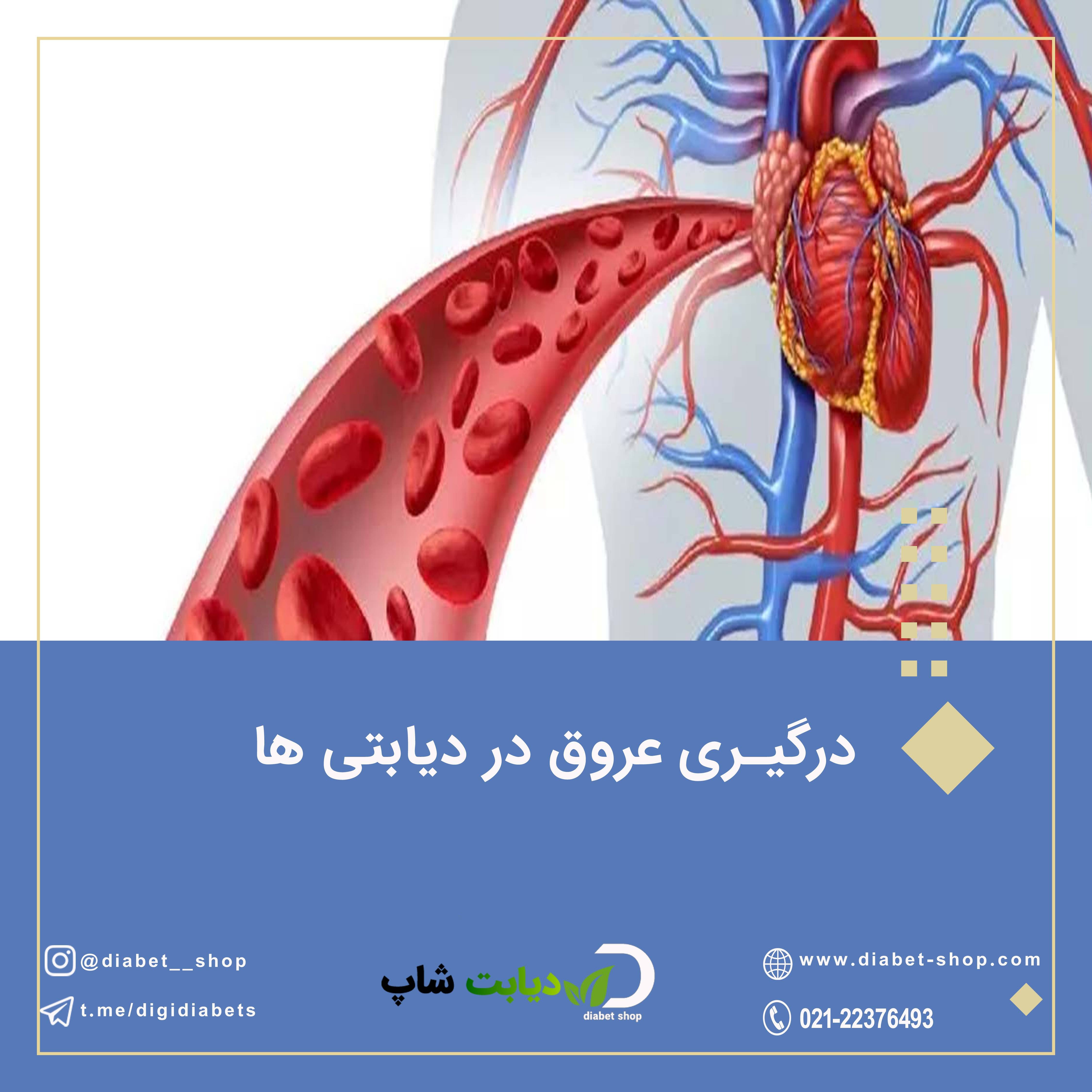 درگیری عروق در دیابتی ها