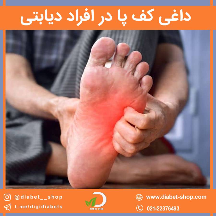 داغی کف پا در افراد دیابتی