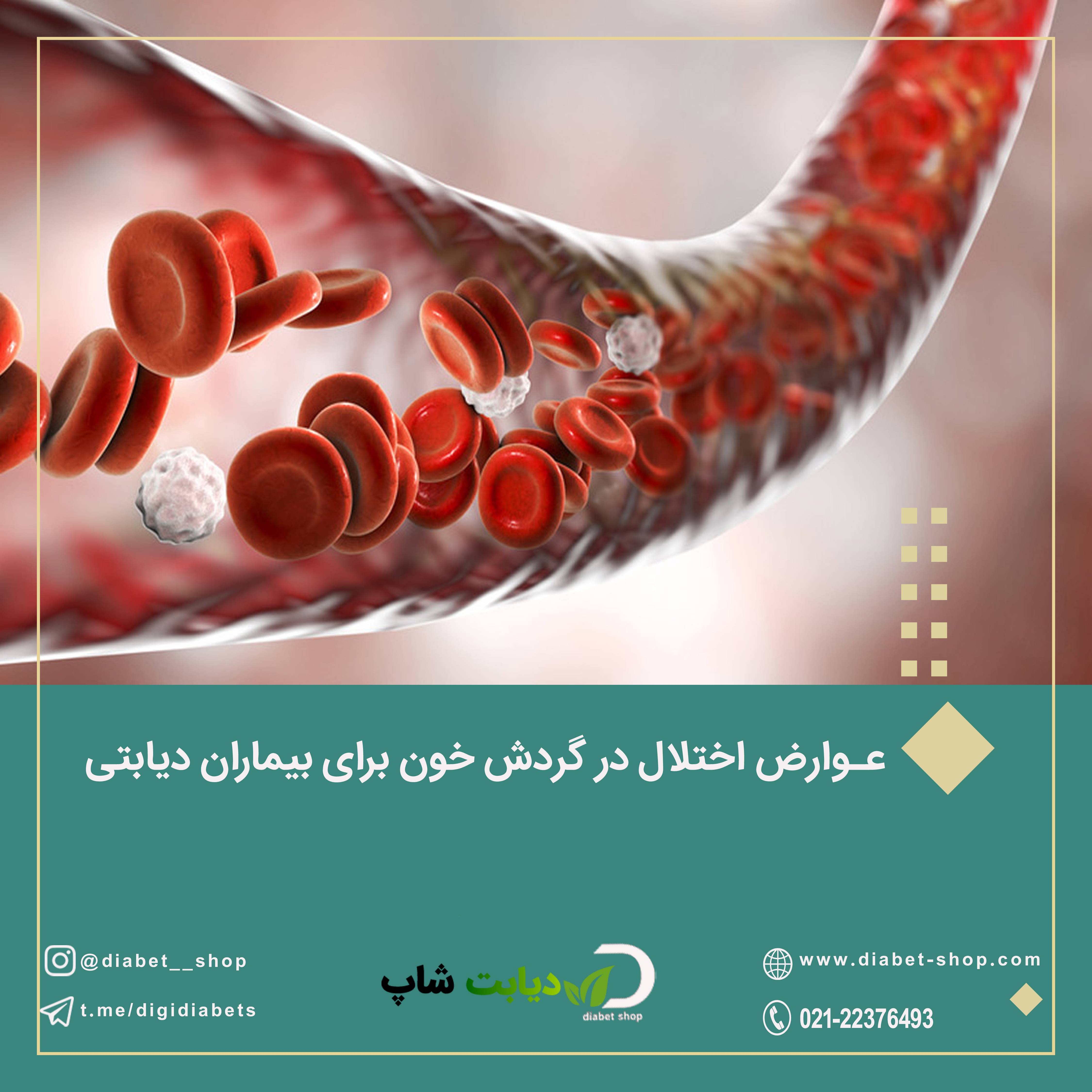 عوارض اختلال در گردش خون برای بیماران دیابتی