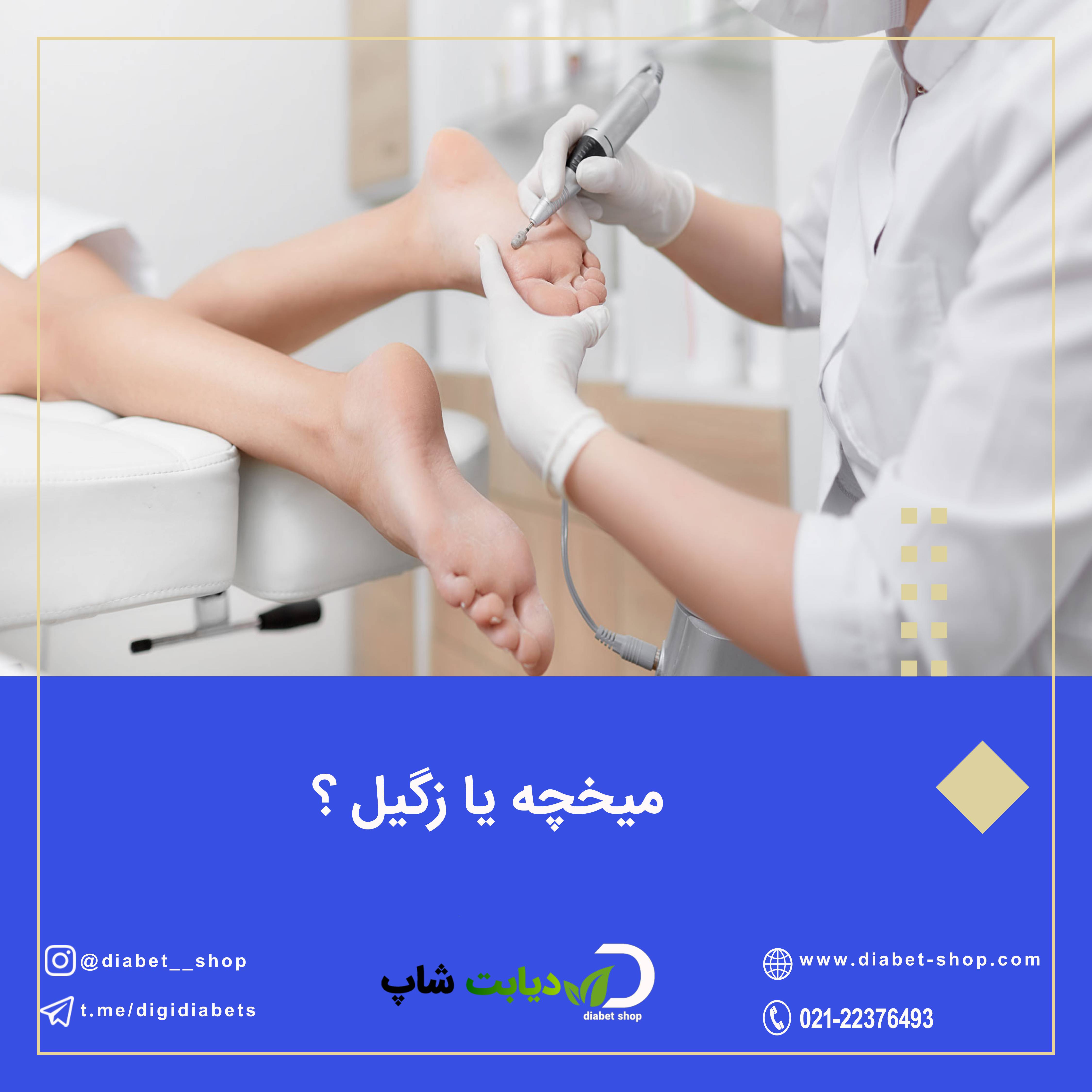 میخچه یا زگیل