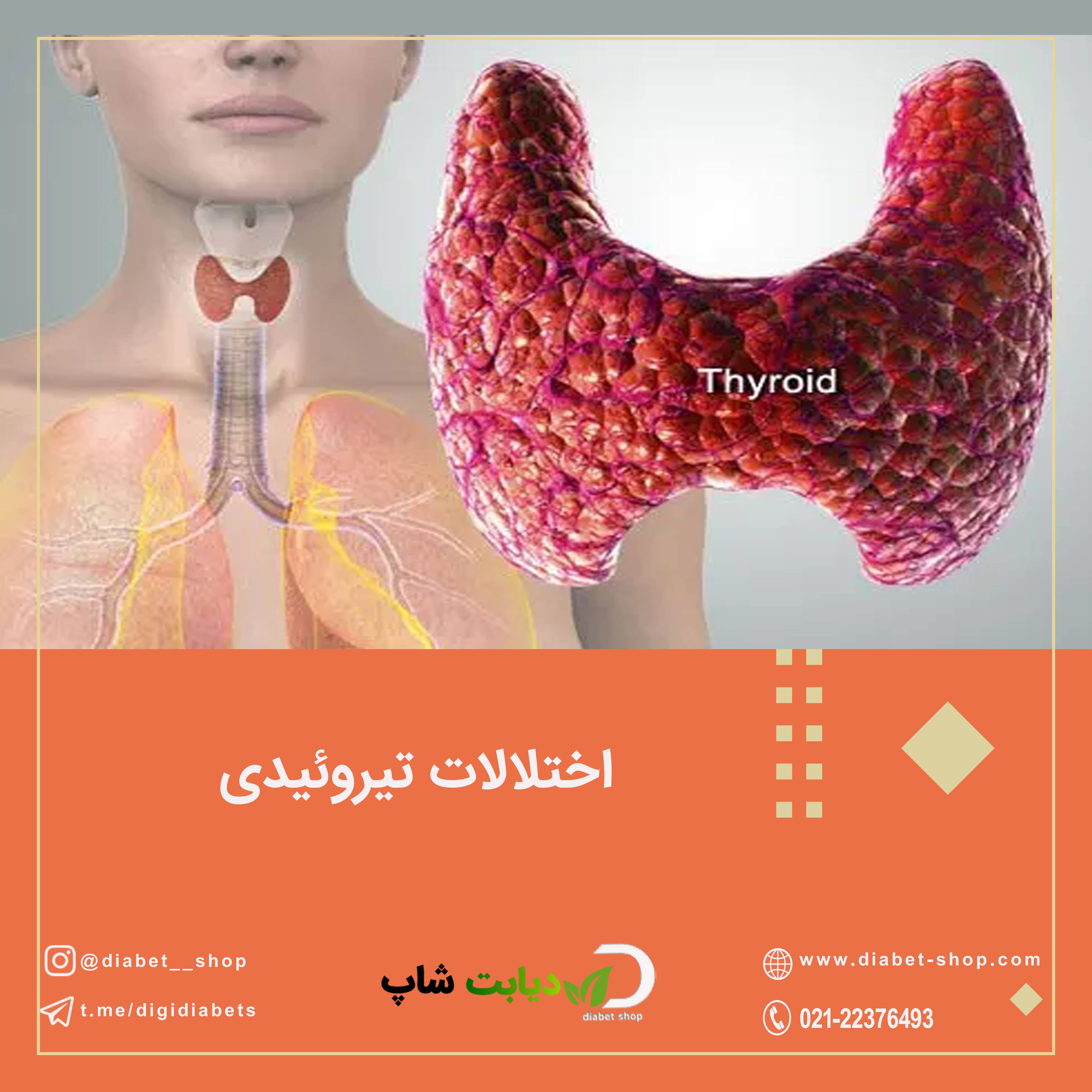 اختلالات تیروئیدی