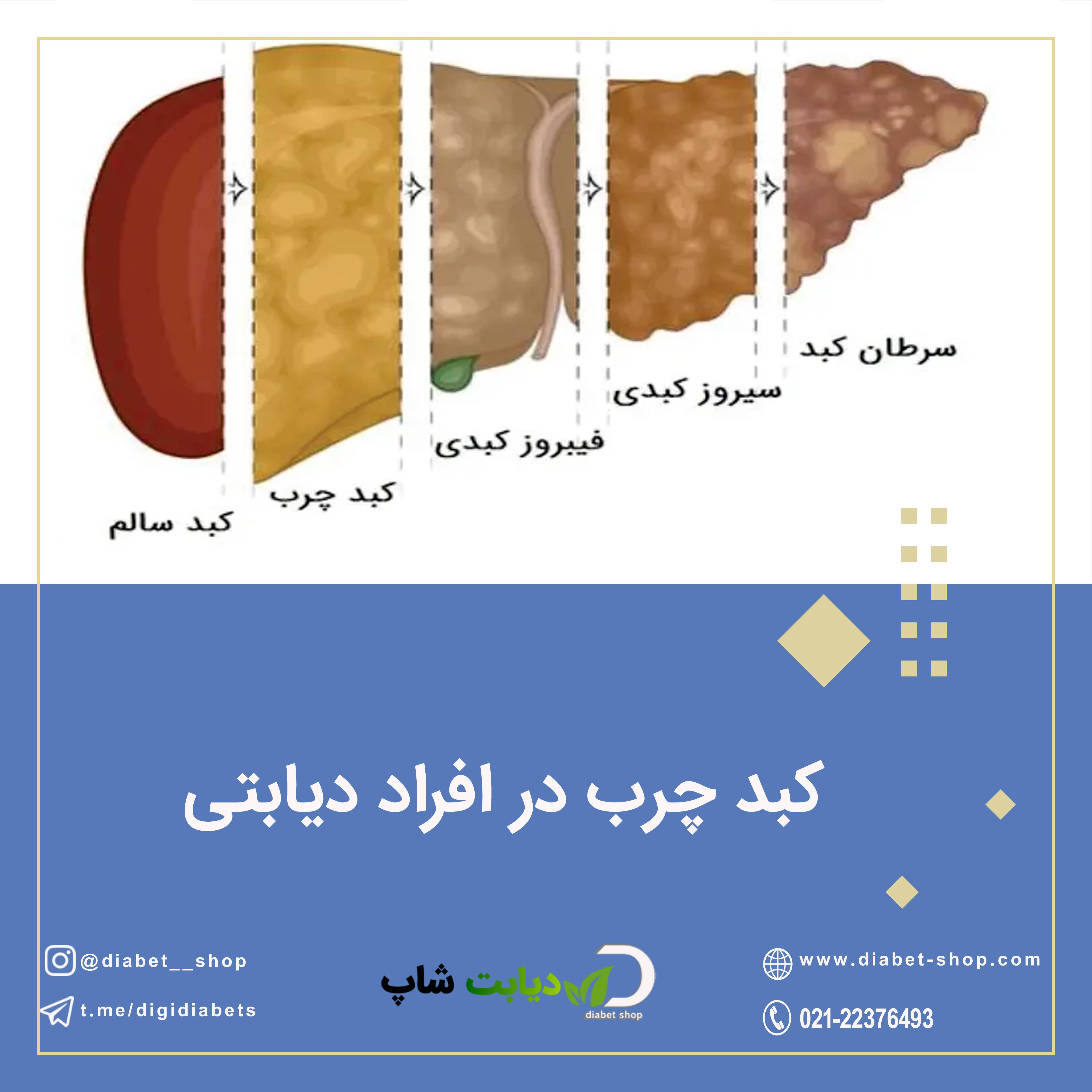 کبد چرب در افراد دیابتی