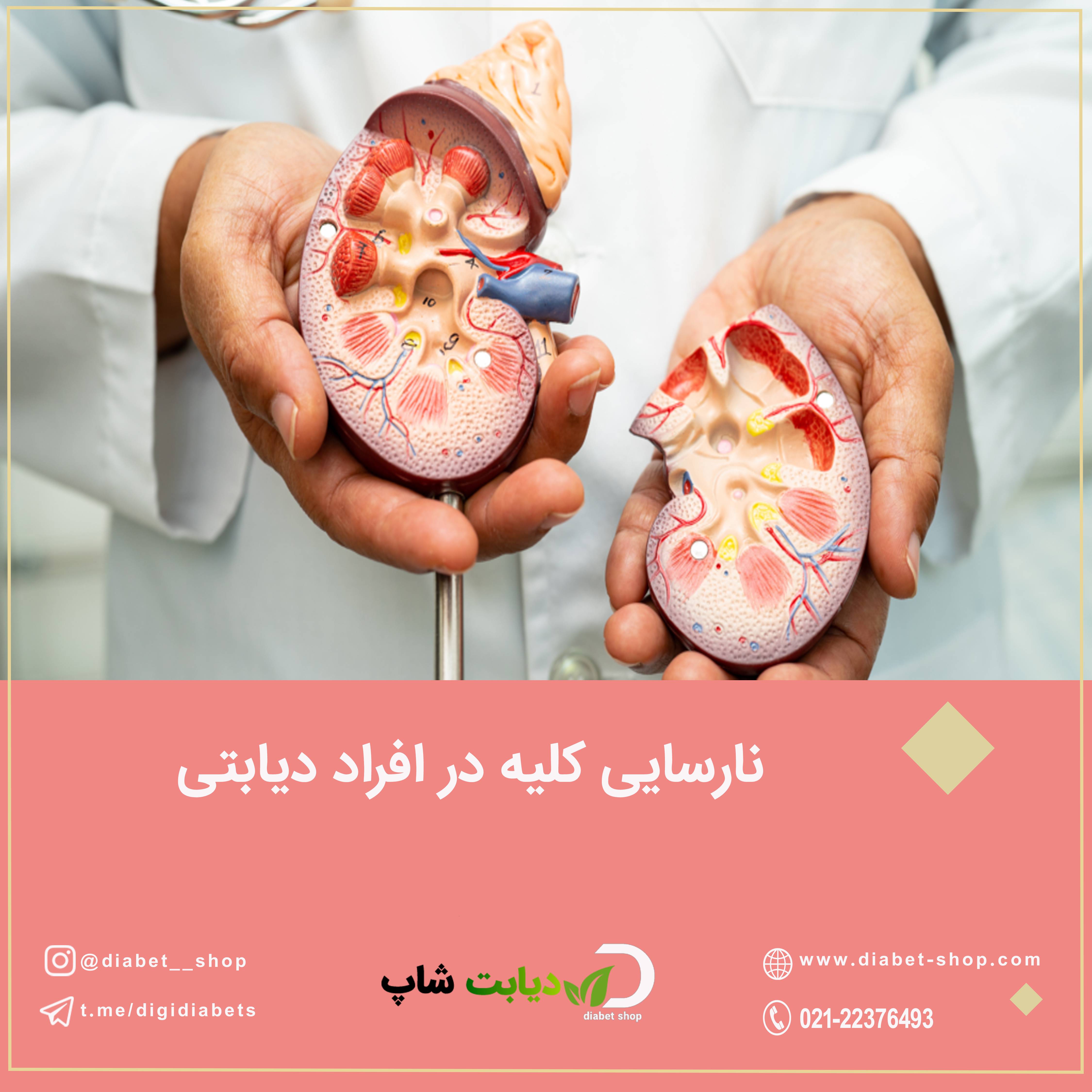 نارسایی کلیه در افراد دیابتی