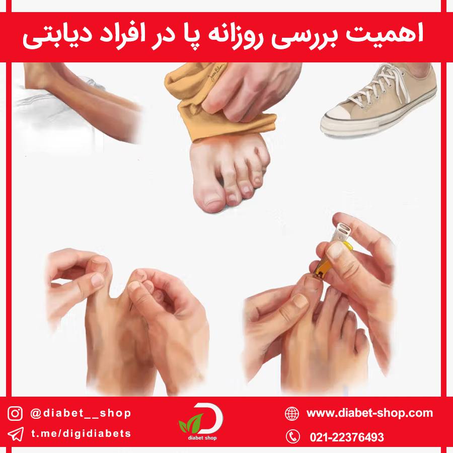اهمیت بررسی روزانه پا در افراد دیابتی