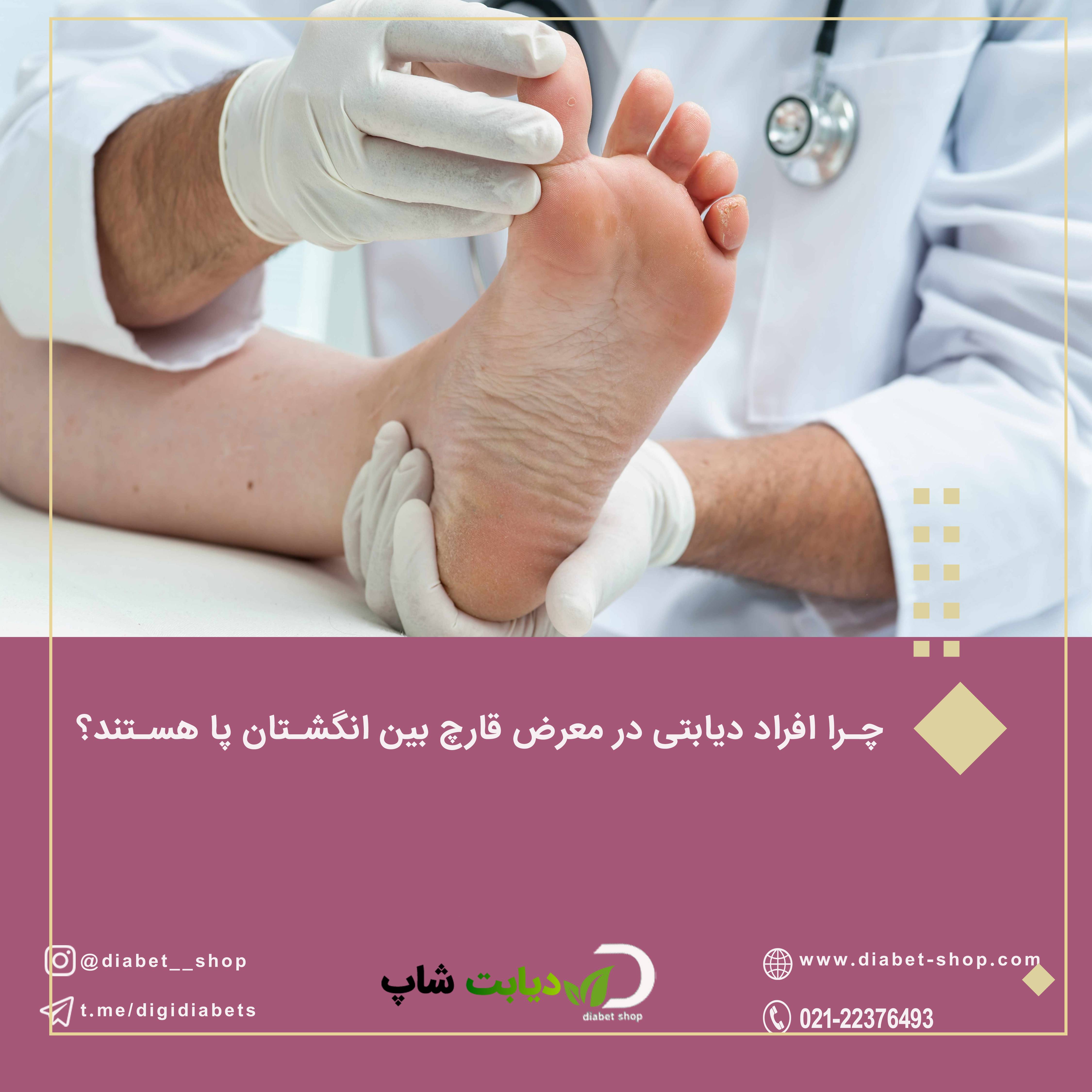 چرا افراد دیابتی در معرض قارچ بین انگشتان پا هستند