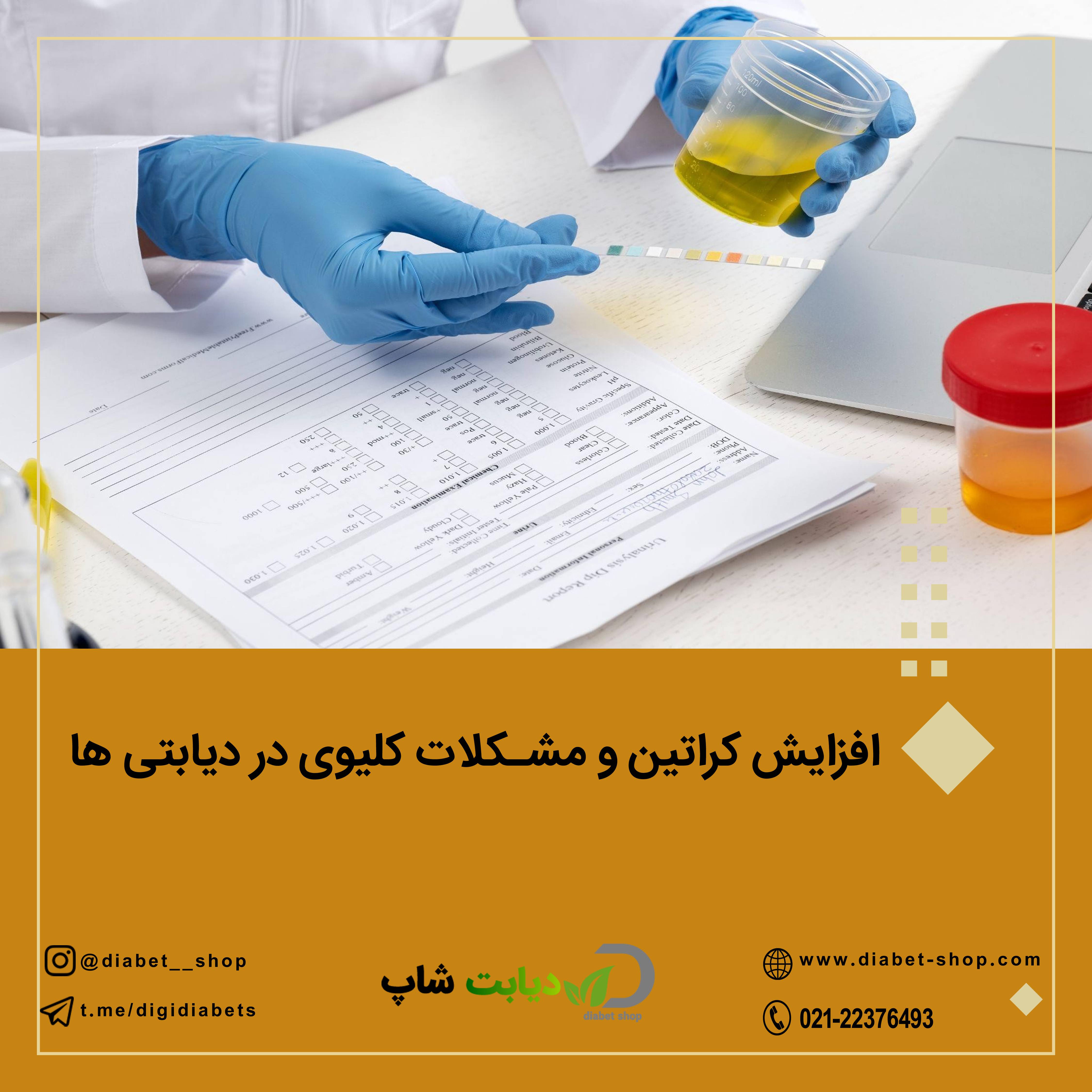 افزایش کراتین و مشکلات کلیوی در دیابتی ‌ها