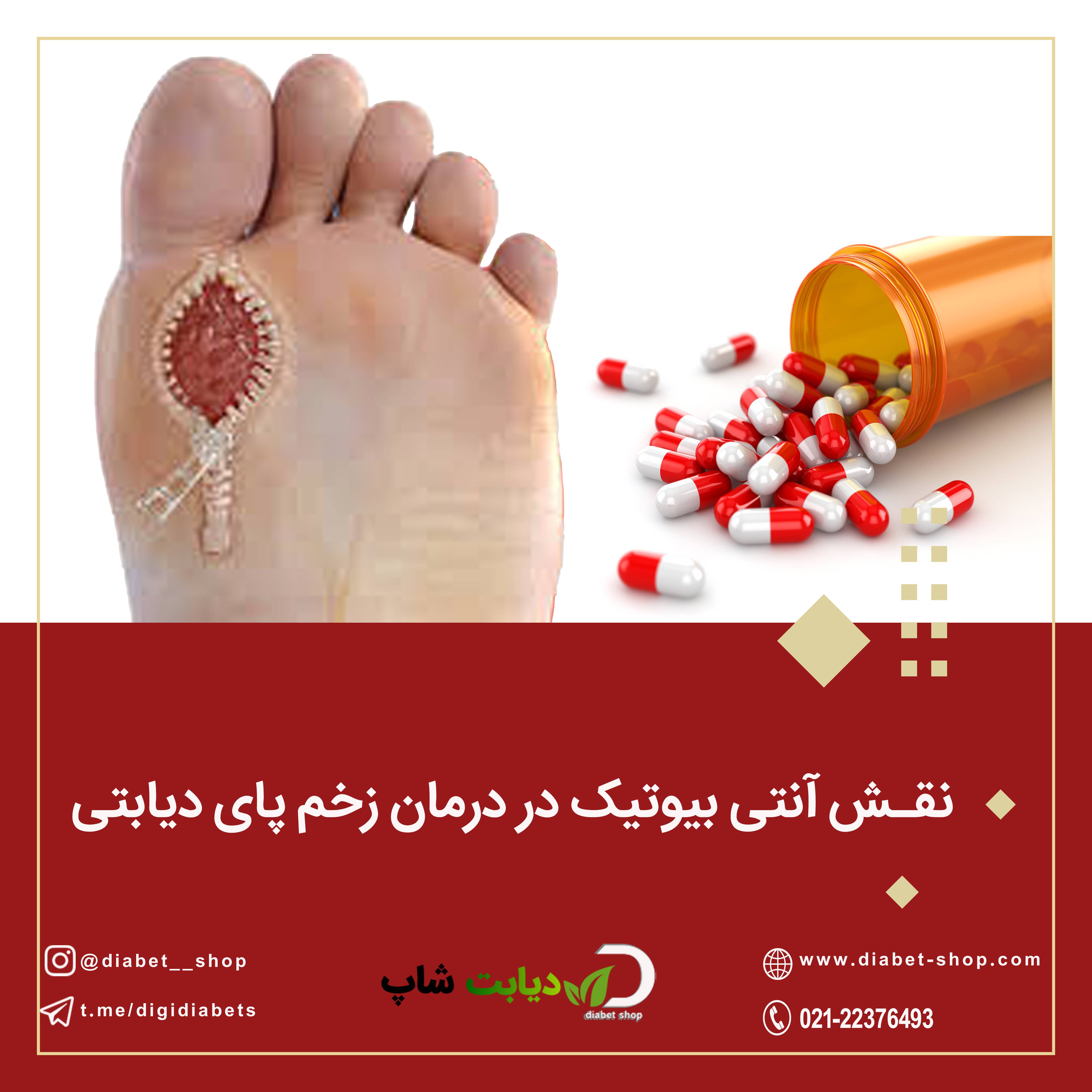 نقش آنتی‌ بیوتیک‌ در درمان زخم پای دیابتی