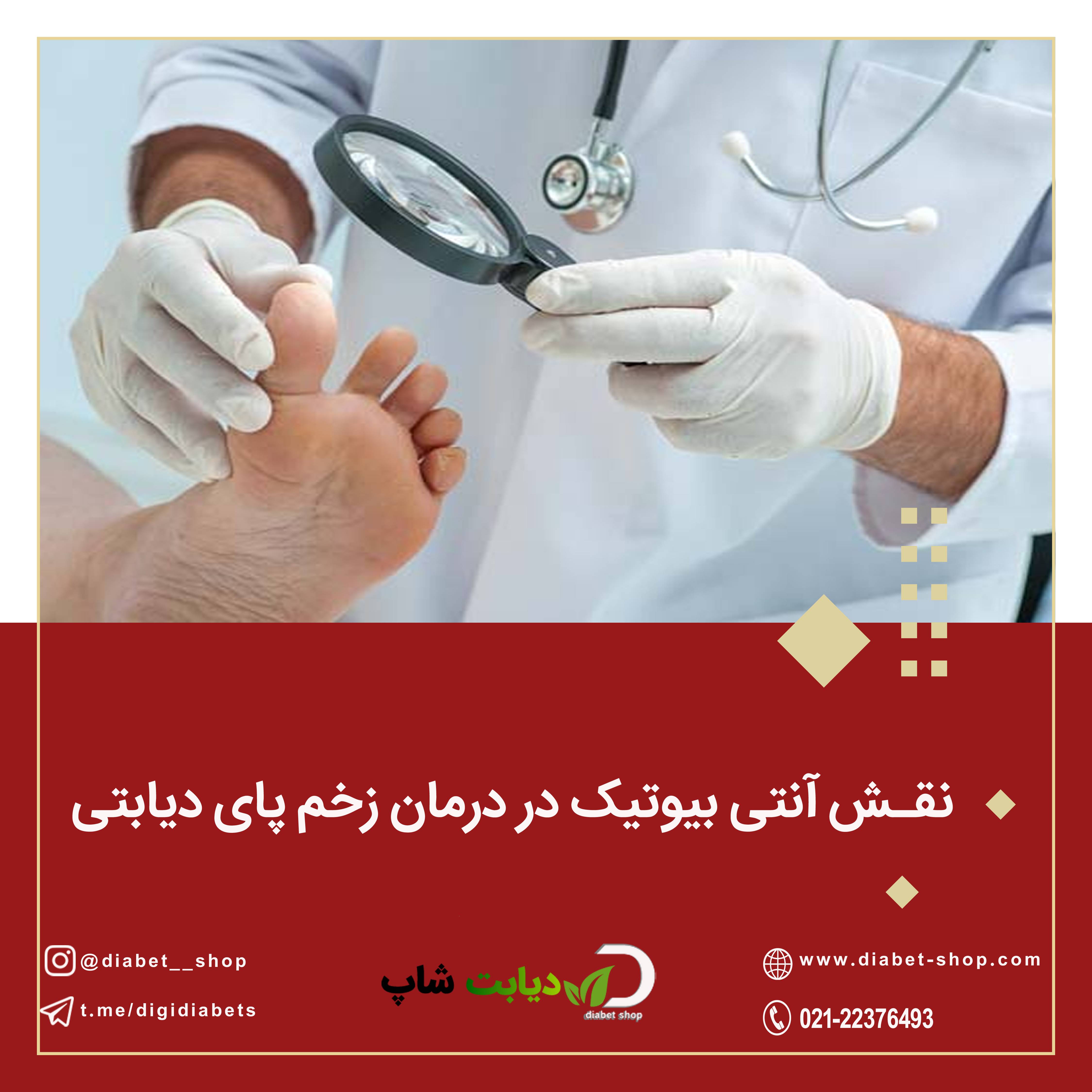 نقش آنتی‌ بیوتیک‌ در درمان زخم پای دیابتی