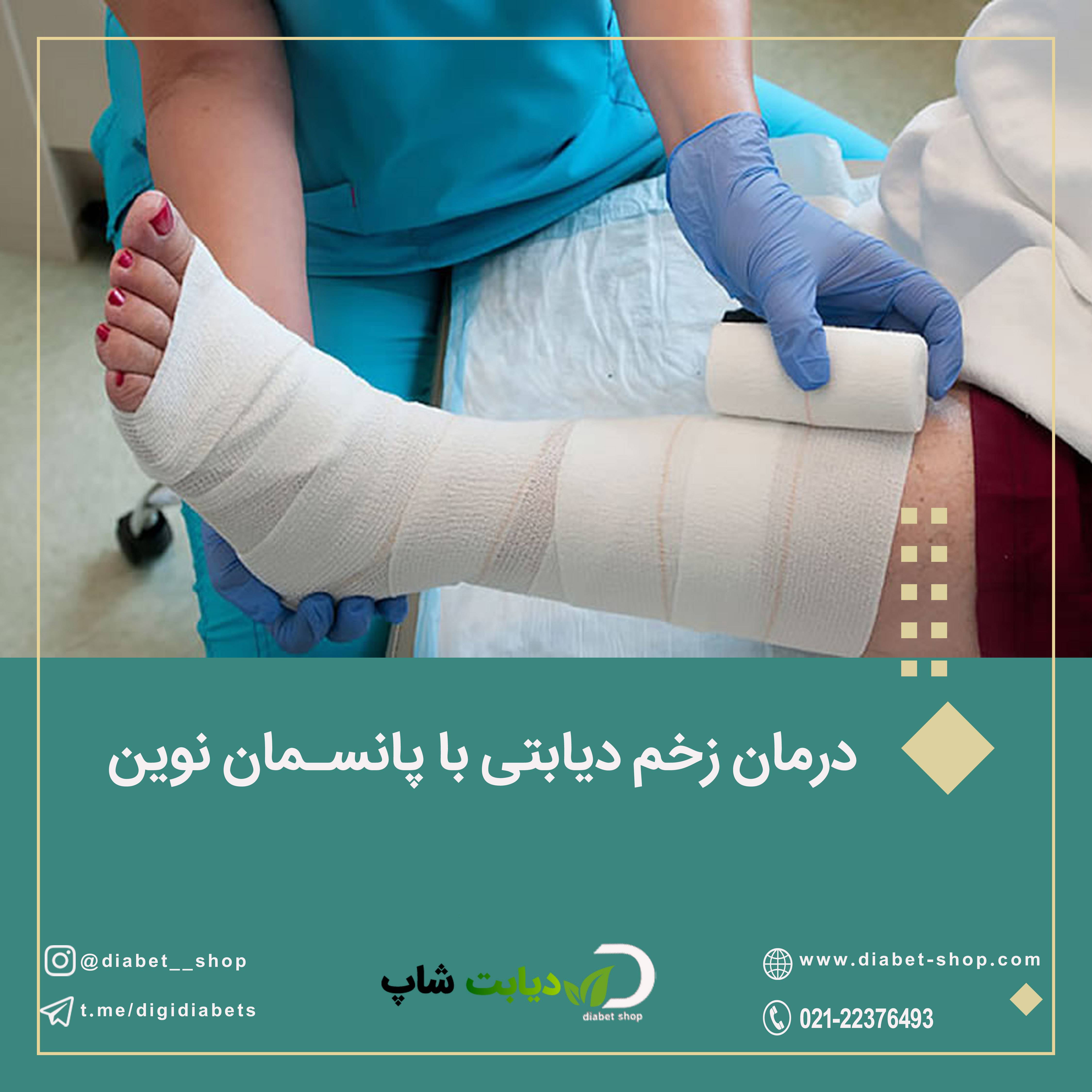 درمان زخم دیابتی با پانسمان نوین	