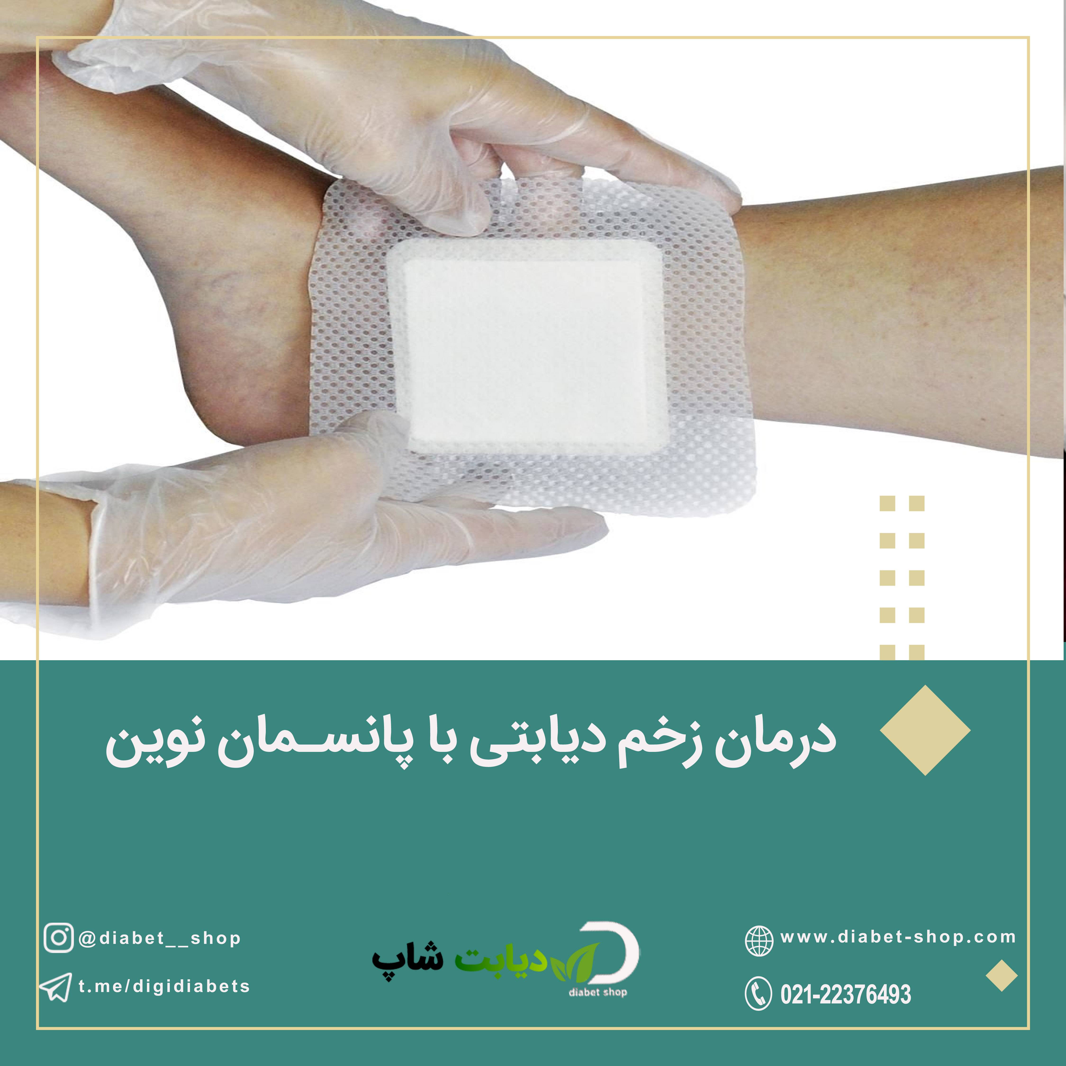درمان زخم دیابتی با پانسمان نوین	