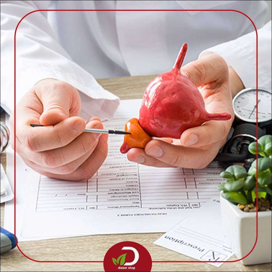 مشکلات ادراری در بیماران دیابتی و تأثیر پروستات