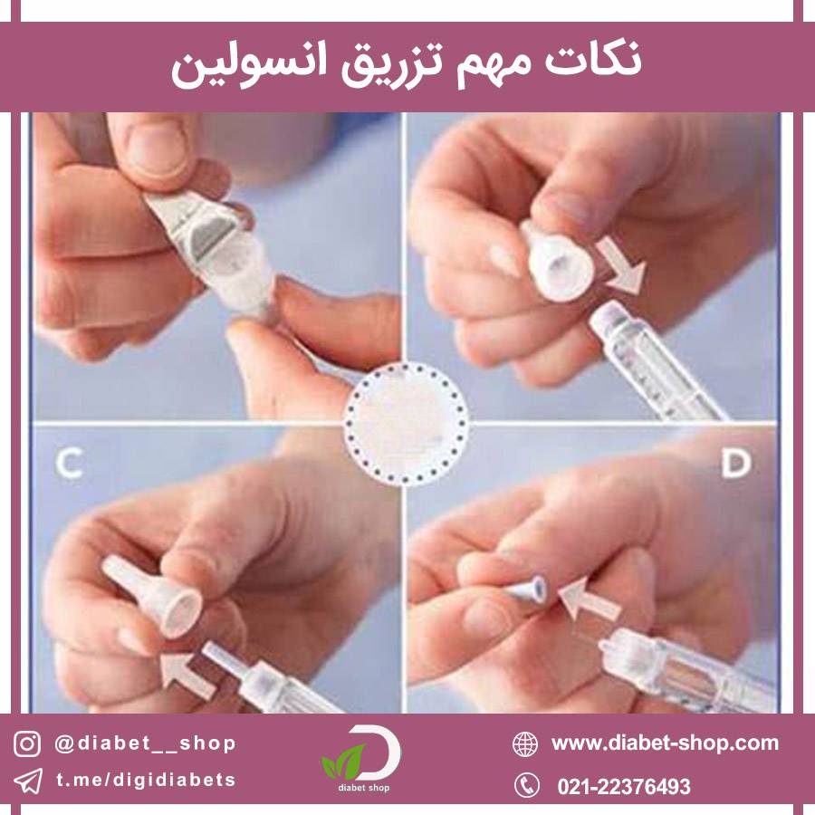 نکات مهم تزریق انسولین