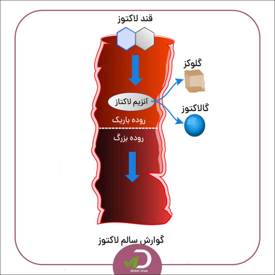 رژیم غذایی مناسب افراد مبتلا به عدم تحمل لاکتوز