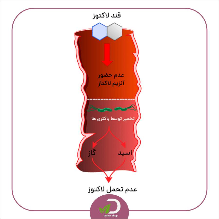 رژیم غذایی مناسب افراد مبتلا به عدم تحمل لاکتوز