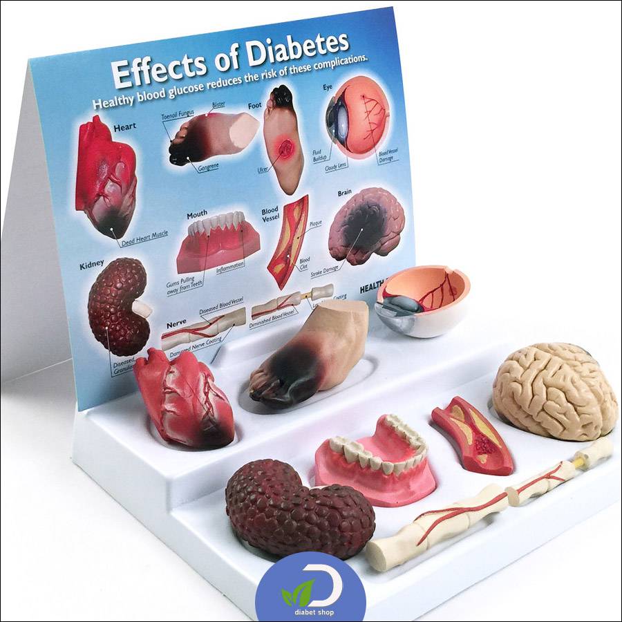 عوارض دیابت بر عروق خونی