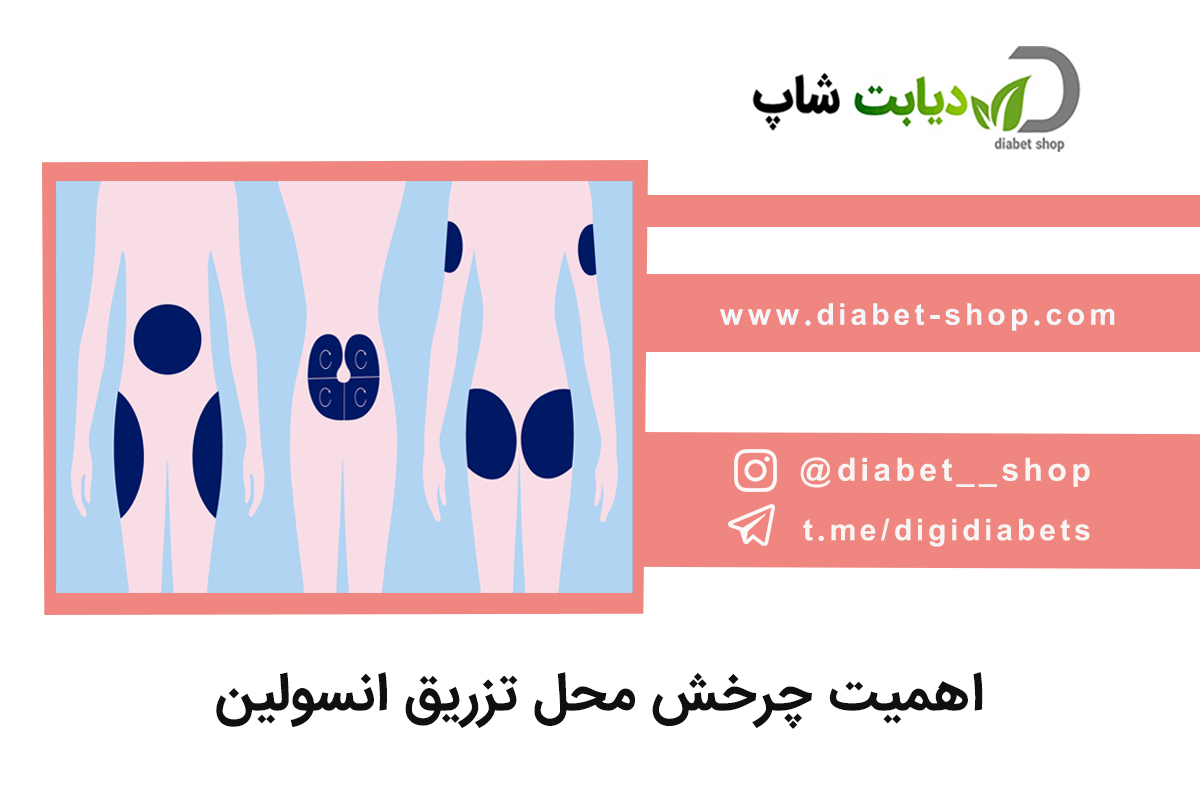 اهمیت چرخش محل تزریق انسولین