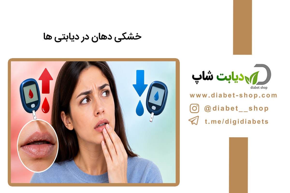 خشکی دهان در دیابتی‌ ها نشانه قند بالا است یا قند پایین؟