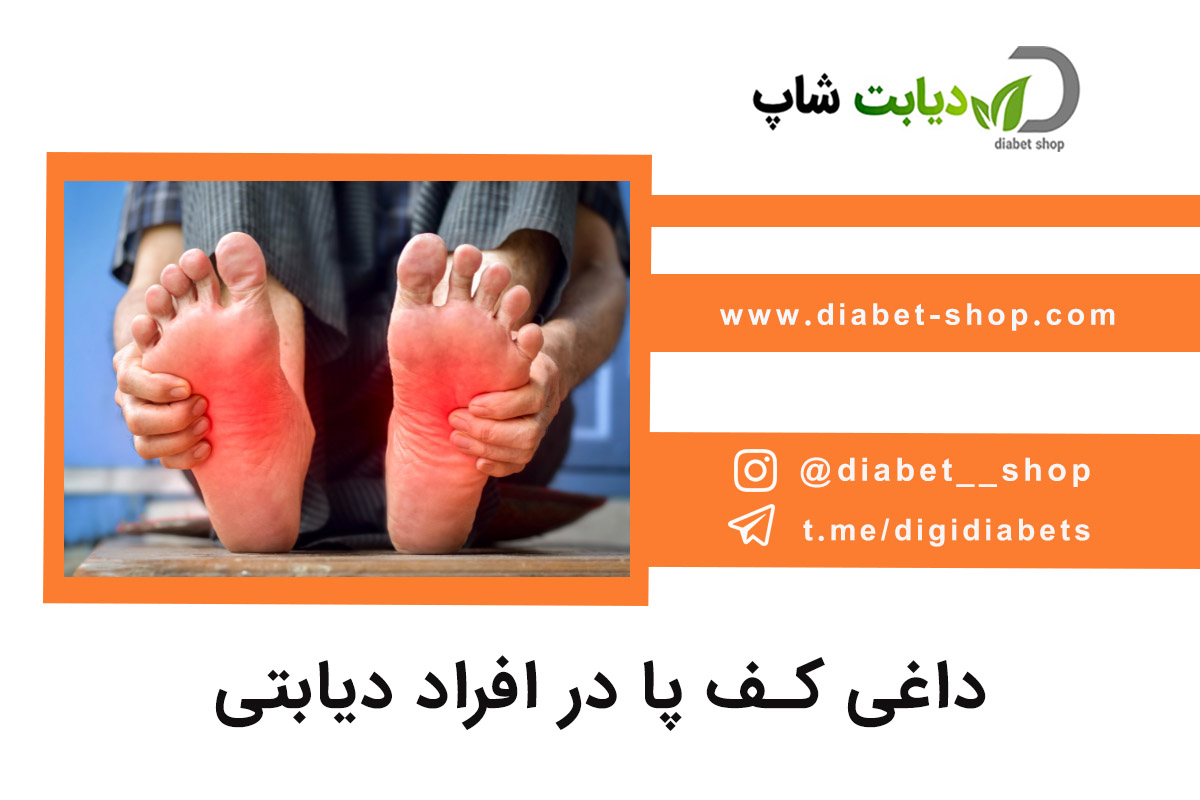 داغی کف پا در افراد دیابتی