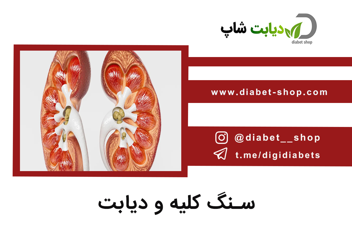 سنگ کلیه و دیابت