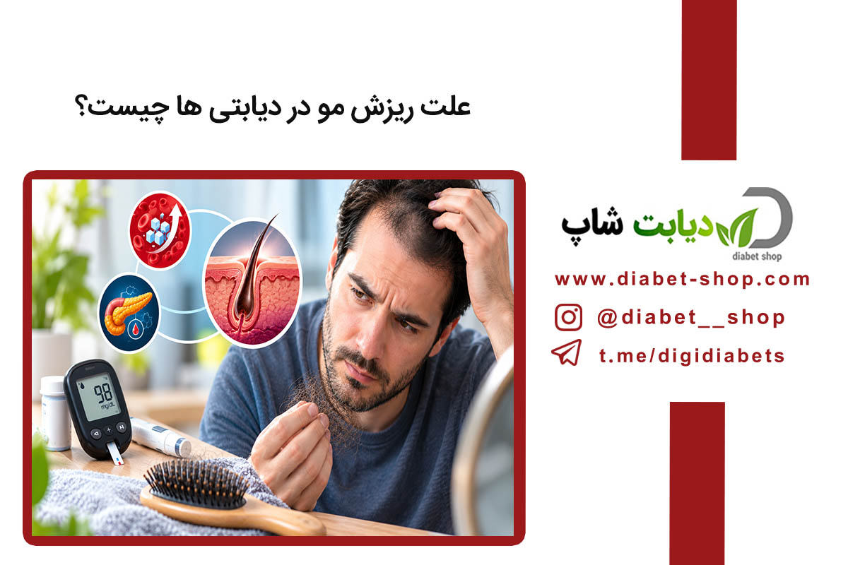 علت ریزش مو در دیابتی ها چیست؟