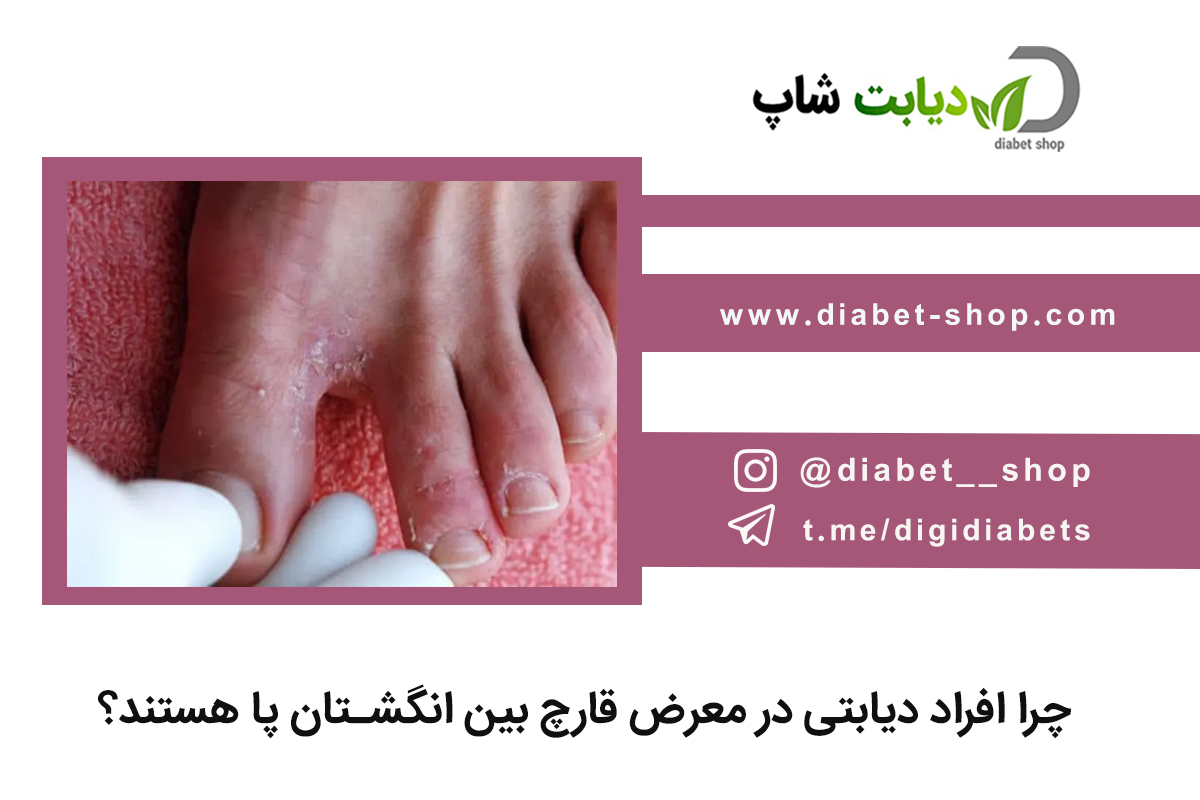 چرا افراد دیابتی در معرض قارچ بین انگشتان پا هستند